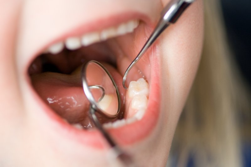 Open mouth receives dental exam